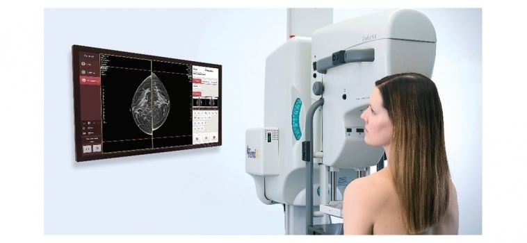 Mammography, part of the history and future of imaging